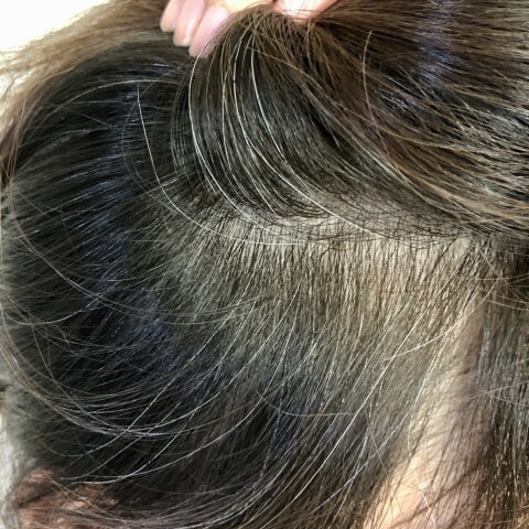 30代で増える 白髪 の悩み 白髪だらけでショック 治る確率は おすすめの白髪染めも紹介 ヨムーノ